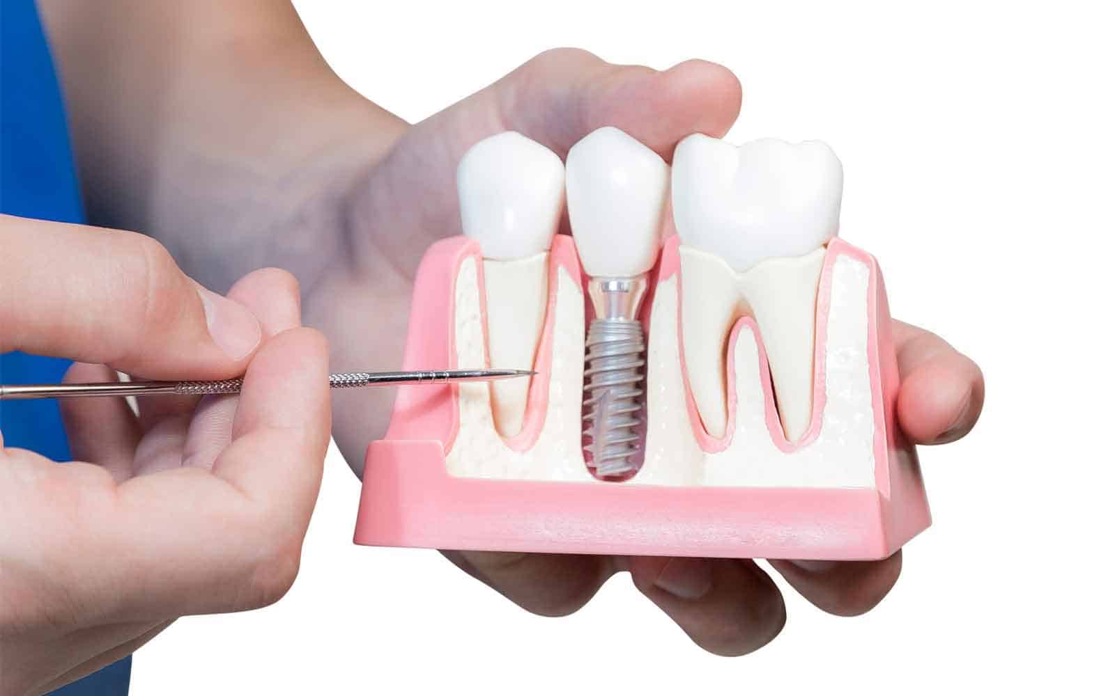 Now Aesthetic: Dental - Teeth Clinic in Turkey & Istanbul