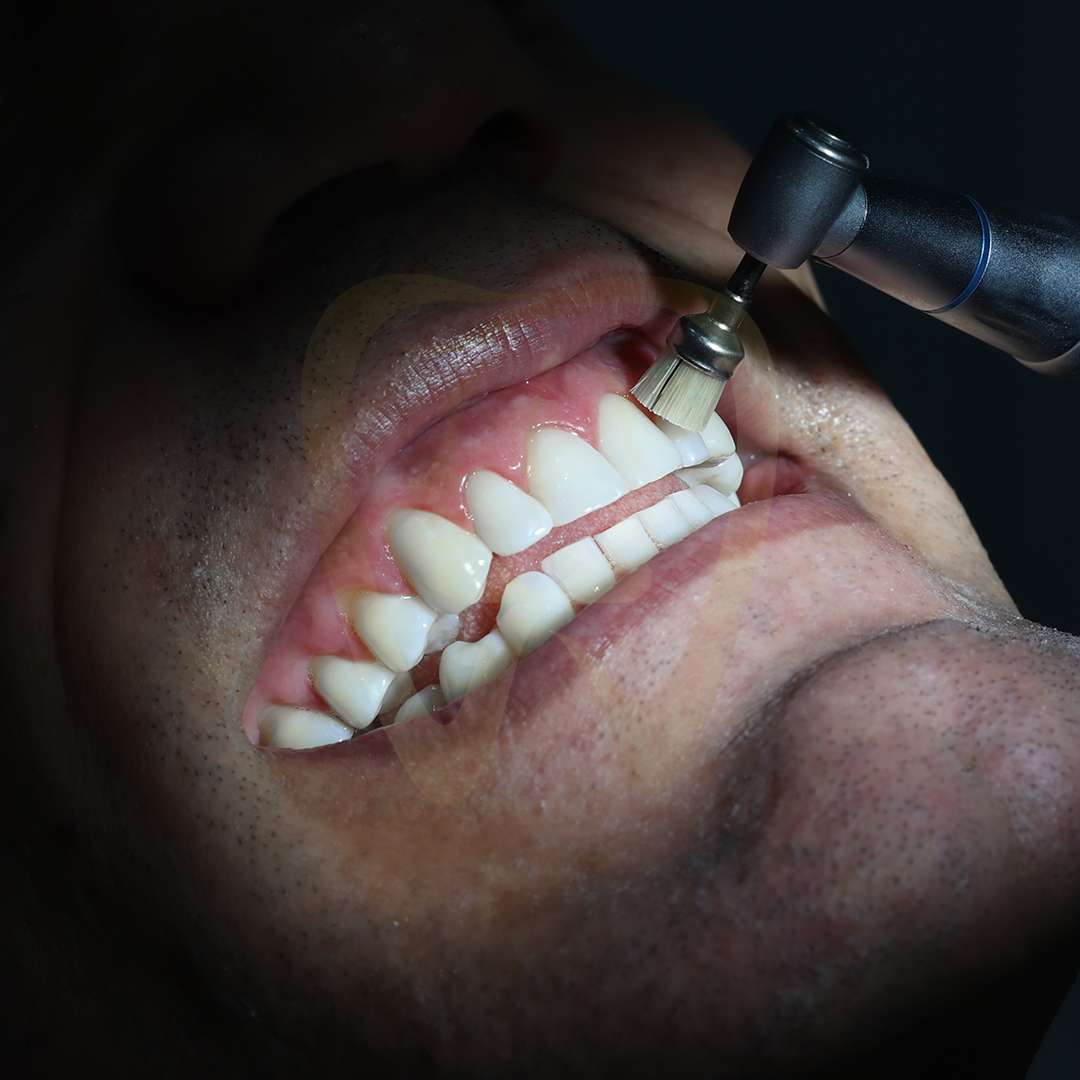 Now Aesthetic: Dental - Teeth Clinic in Turkey & Istanbul